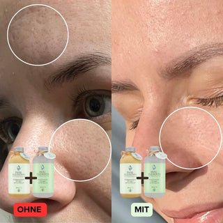 Gesichtswasser •Energie• mit Frangipani - Pure Elements Naturkosmetik